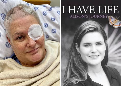 alison botha hospital photos.